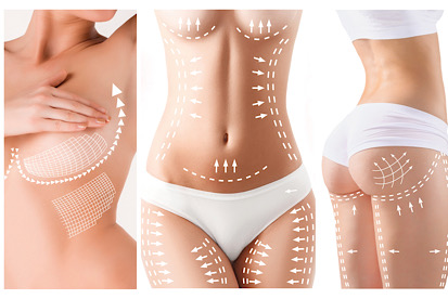 Tratamiento Evolution BodyTone